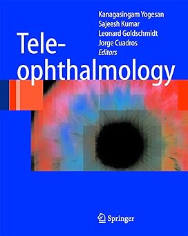 TELEOPHTHALMOLOGY