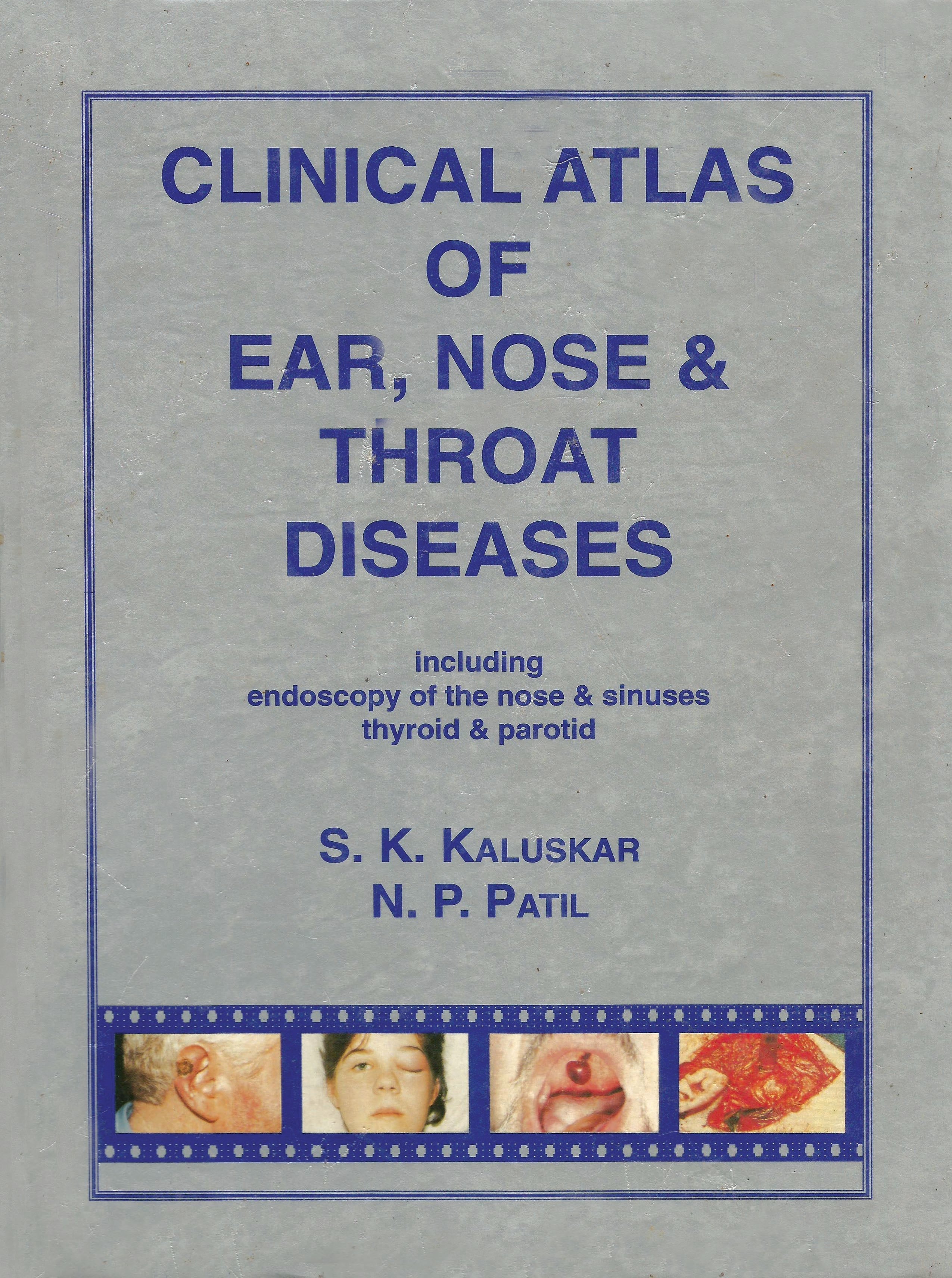 Clinical Atlas Of Ear, Nose & Throat Disease