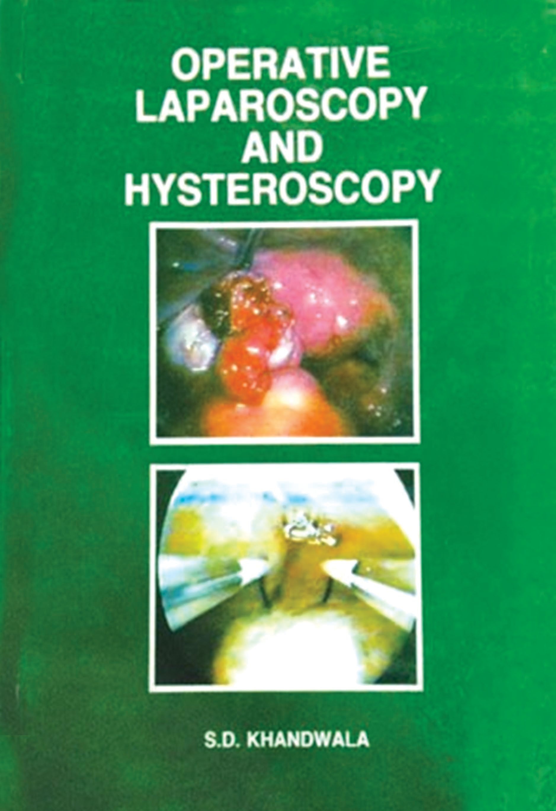 Operative Laparoscopy And Hysteroscopy