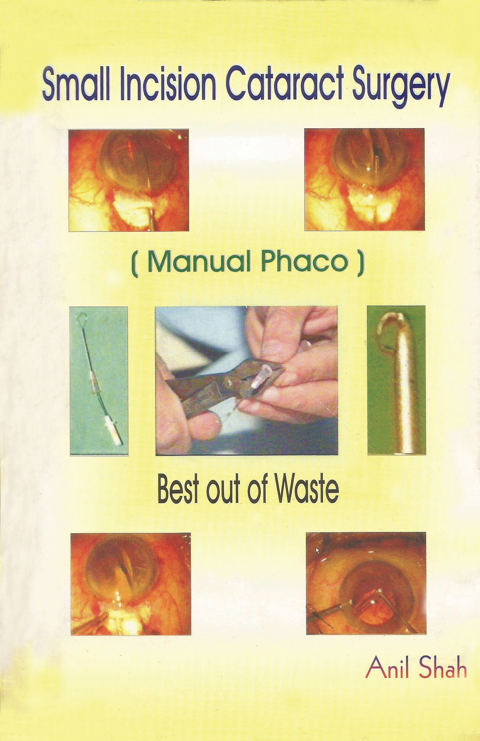 Great Cataract Incision Small Incision Cataract Surgery With Cd