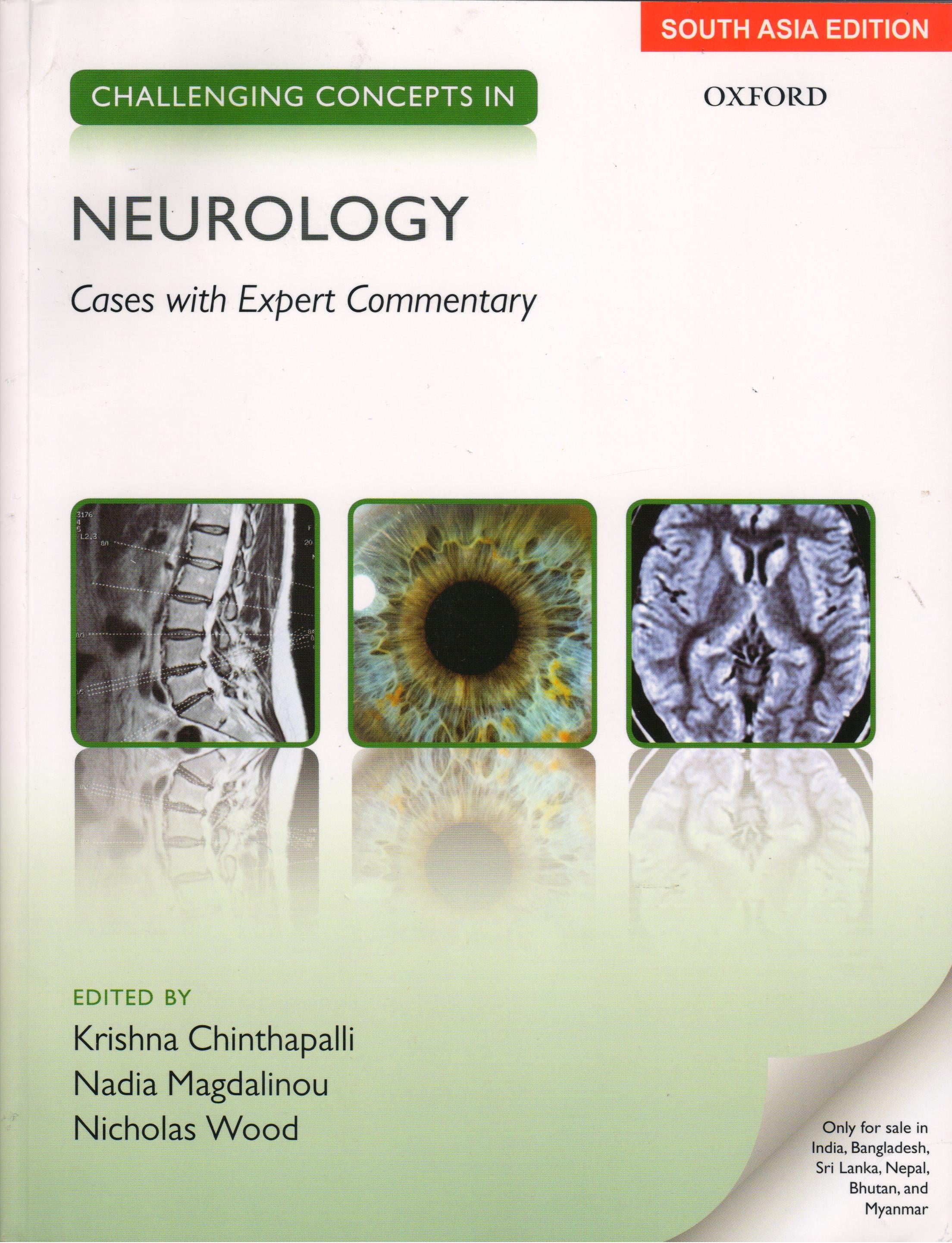 Challenging Concepts in Neurology