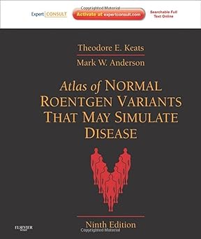 Atlas of Normal Roentgen Variants 9/e