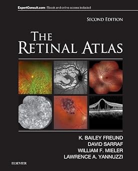 The Retinal Atlas - 2E