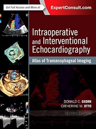 Intraoperative and Interventional Echocardiography: Atlas of Transesophageal Imaging - 2E