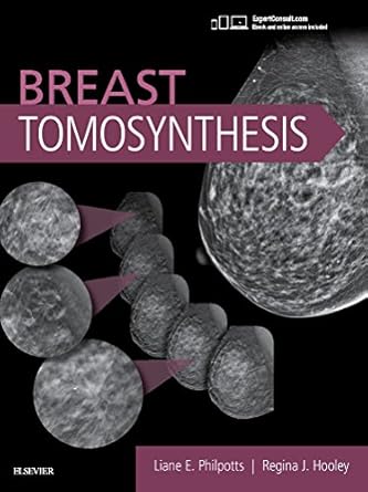 Breast Tomosynthesis -1E