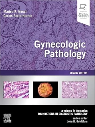 Gynecologic Pathology : A Volume in the Foundations in Diagnostic Pathology Series - 2E