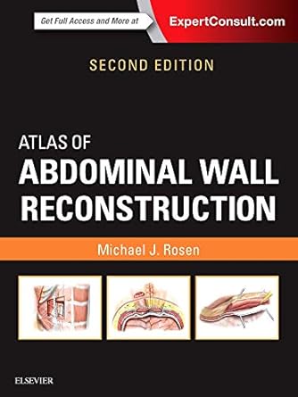 Atlas of Abdominal Wall Reconstruction -2E