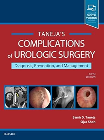 Complications of Urologic Surgery: Prevention and Management - 5E