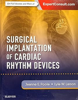 Surgical Implantation of Cardiac Rhythm Devices - 1E