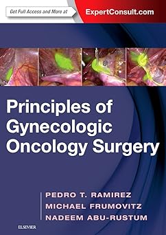 Principles of Gynecologic Oncology Surgery - 1E