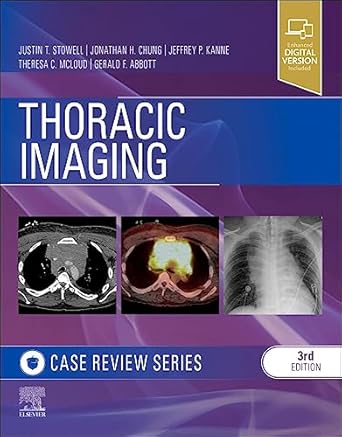 Thoracic Imaging: Case Review - 3E