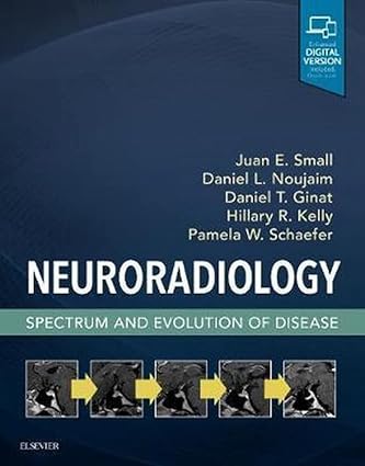 Neuroradiology: Spectrum and Evolution of Disease - 1E