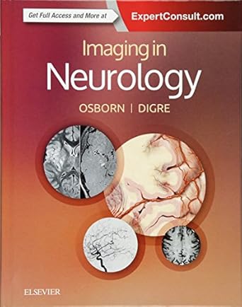 Imaging in Neurology