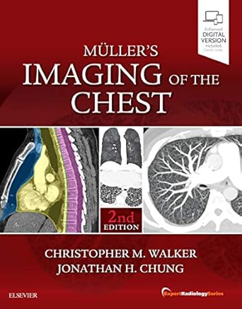 Muller's Imaging of the Chest -2E