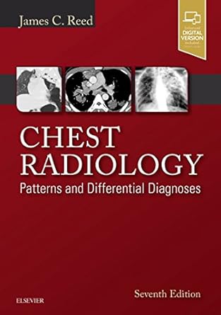 Chest Radiology: Patterns and Differential Diagnoses -7E