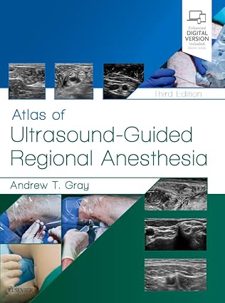 Atlas of Ultrasound-Guided Regional Anesthesia: Expert Consult -3E