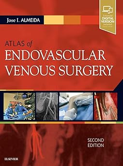 Atlas of Endovascular Venous Surgery: Expert Consult - Online and Print - 2E