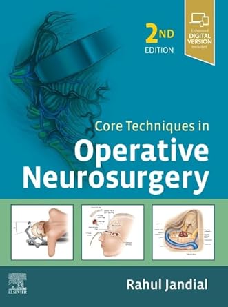 Core Techniques in Operative Neurosurgery: Expert Consult - Online and Print - 2E