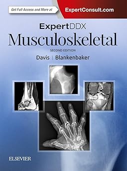 ExpertDDx: Musculoskeletal - 2E