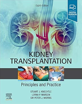 Kidney Transplantation - Principles and Practice: Expert Consult - Online and Print - 8E