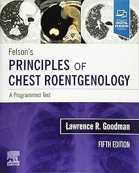 Felson's Principles of Chest Roentgenology, A Programmed Text: A Programmed Text - 5E