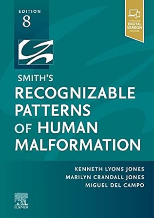 Smith's Recognizable Patterns of Human Malformation - 8E