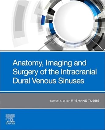 Anatomy, Imaging and Surgery of the Intracranial Dural Venous Sinuses-1E