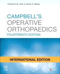 Campbell's Operative Orthopaedics IE - (4-Vol Set) - 14E