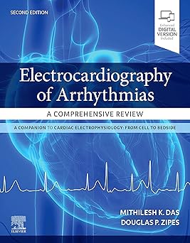 Electrocardiography of Arrhythmias: A Comprehensive Review-2E