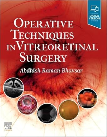 Operative Techniques in Vitreoretinal Surgery-1E