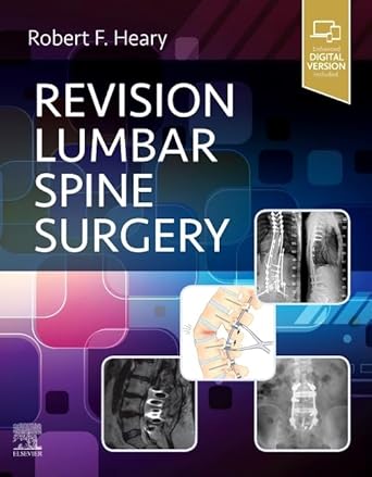 Revision Lumbar Spine Surgery-1E