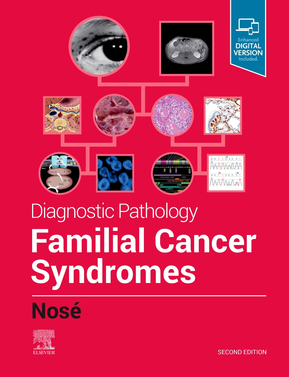 Diagnostic Pathology: Familial Cancer Syndromes, 2e