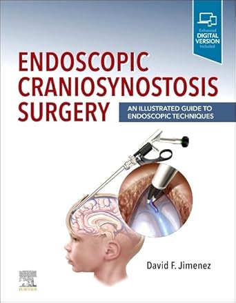 Endoscopic Craniosynostosis Surgery: An Illustrated Guide to Endoscopic Techniques - 1E