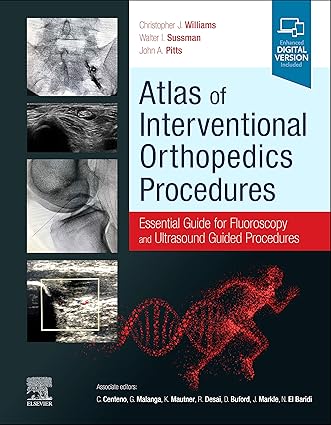 Atlas of Interventional Orthopedics Procedures: Essential Guide for Fluoroscopy and Ultrasound Guided Procedures - 1E