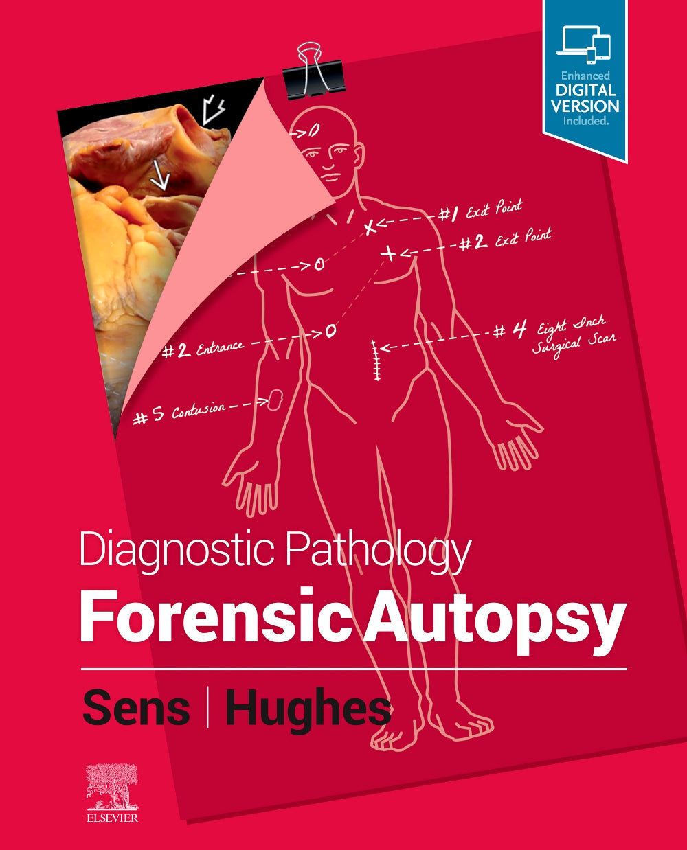 Diagnostic Pathology: Forensic Autopsy:  1ed