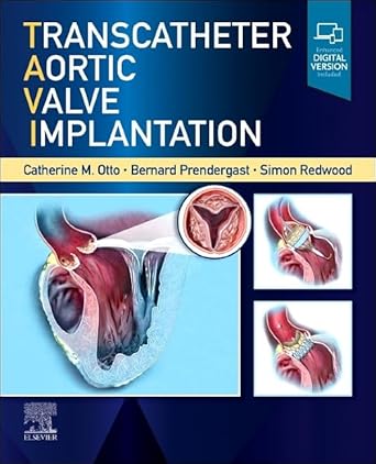 Transcatheter Aortic Valve Implantation - 1E