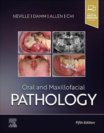 Oral and Maxillofacial Pathology - 5E