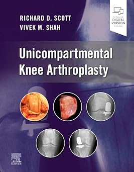 Unicompartmental Knee Arthroplasty-1E