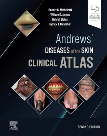 Andrews' Diseases of the Skin Clinical Atlas - 2E