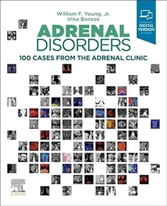 Adrenal Disorders: 100 Cases from the Adrenal Clinic - 1E