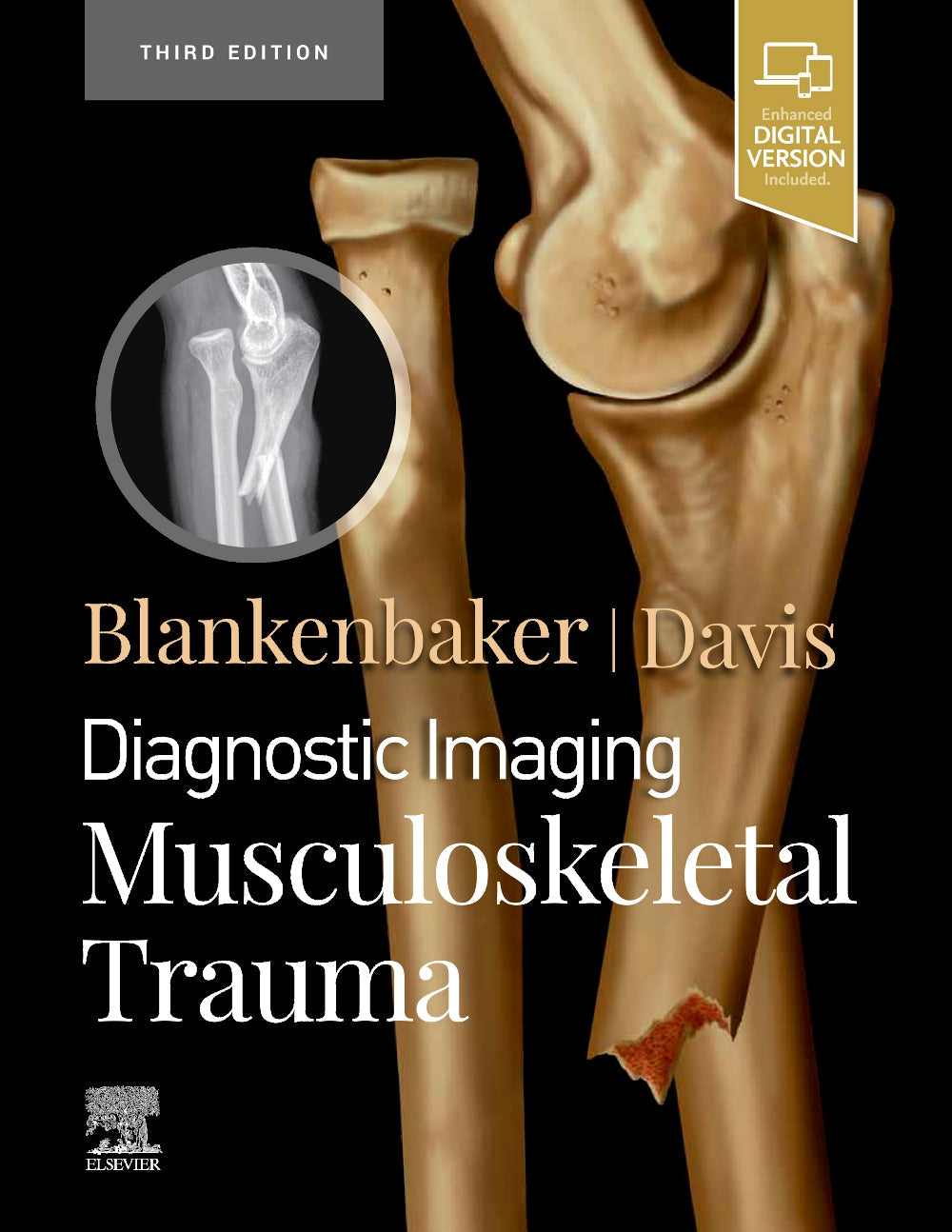 Diagnostic Imaging: Musculoskeletal Trauma:  3ed