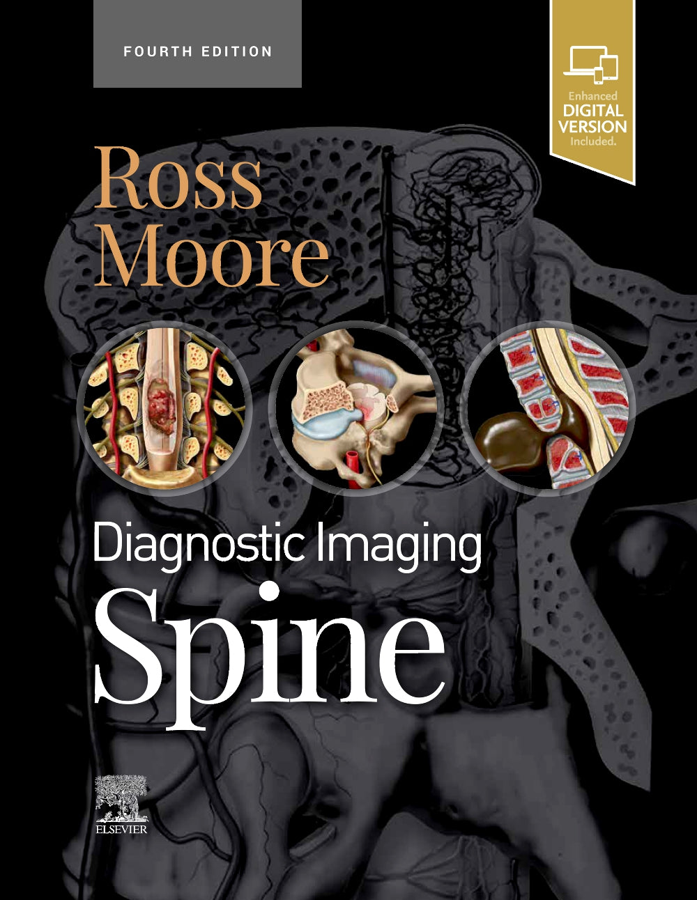 æDiagnostic Imaging: Spine:4ed