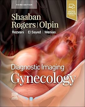 Diagnostic Imaging: Gynecology