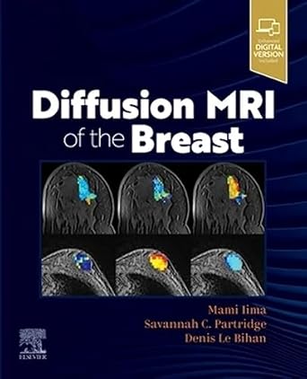 Diffusion MRI of the Breast - 1E