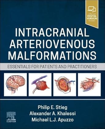 Intracranial Arteriovenous Malformations: Essentials for Patients and Practitioners - 1E