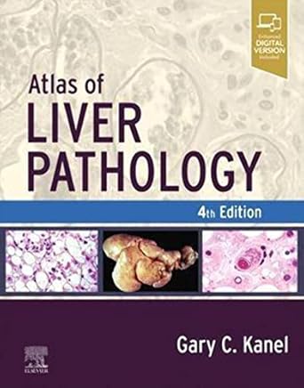 Atlas of Liver Pathology - 4E