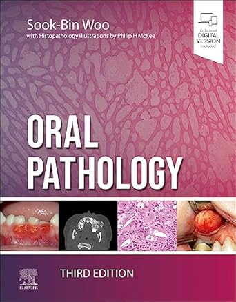 Oral Pathology - 3E