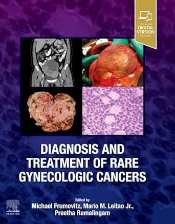 Diagnosis and Treatment of Rare Gynecologic Cancers - 1E