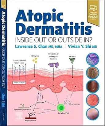 Atopic Dermatitis: Inside Out or Outside In - 1E