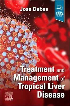 Treatment and Management of Tropical Liver Disease:  1E